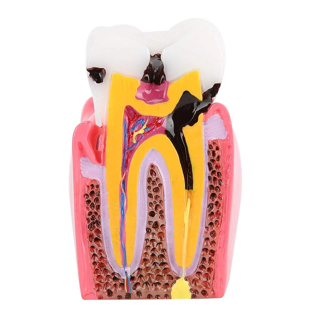 Zahnanatomie-Modell aus Harz für Dentallabor Mundpflege